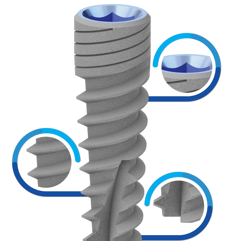 bioline spiral